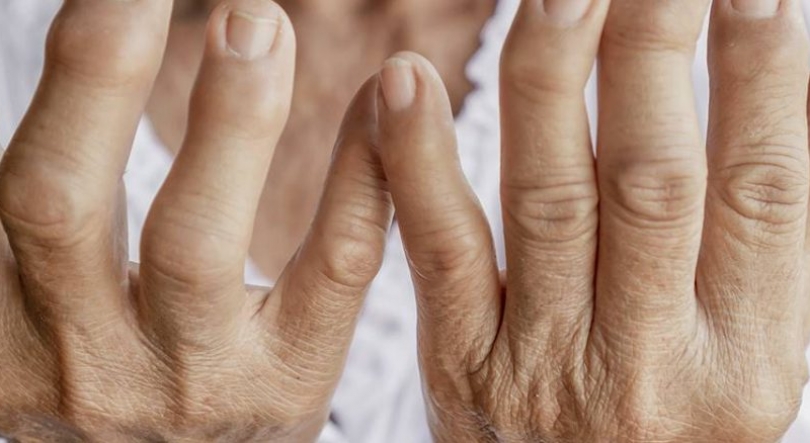 Imagem de Duas irmãs, dois sistema de saúde